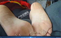 Ten thousand needle puncture foot torture